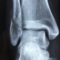 ortho